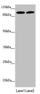 Western blot All lanes: PDE6A antibody at 3.33µg/ml Lane 1: Mouse eye tissue Lane 2: A549 whole cell lysate Secondary Goat polyclonal to rabbit IgG at 1/10000 dilution Predicted band size: 100 kDa Observed band size: 100 kDa