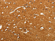 The image on the left is immunohistochemistry of paraffin-embedded Human brain tissue using CSB-PA211509(SLC4A4 Antibody) at dilution 1/50, on the right is treated with fusion protein. (Original magnification: ×200)