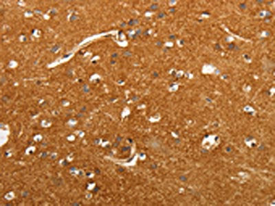 The image on the left is immunohistochemistry of paraffin-embedded Human brain tissue using CSB-PA211509(SLC4A4 Antibody) at dilution 1/50, on the right is treated with fusion protein. (Original magnification: ×200)