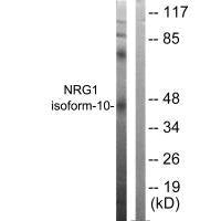 Western blot analysis of extracts from SKOV3 cells, using NRG1 isoform-10 antibody.