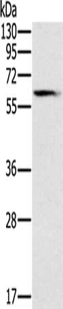 Gel: 8%SDS-PAGE, Lysate: 40 ug, Lane: Human fetal brain tissue, Primary antibody: CSB-PA211673(SLC45A3 Antibody) at dilution 1/200, Secondary antibody: Goat anti rabbit IgG at 1/8000 dilution, Exposure time: 2 minutes