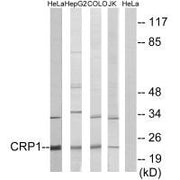 Western blot analysis of extracts from HeLa, HepG2 cells, COLO cells and Jurkat cells, using CRP1 antibody.