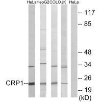 Western blot analysis of extracts from HeLa, HepG2 cells, COLO cells and Jurkat cells, using CRP1 antibody.