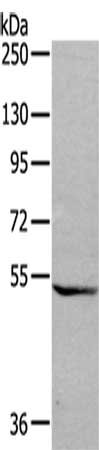 Gel: 6%SDS-PAGE,Lysate: 40 ug,,Primary antibody: CSB-PA211811(GDF7 Antibody) at dilution 1/200 dilution,Secondary antibody: Goat anti rabbit IgG at 1/8000 dilution,Exposure time: 3 minutes