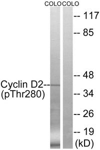 Western blot analysis of extracts from COLO cells, treated with EGF (200ng/ml, 30mins), using Cyclin D2 (Phospho-Thr280) antibody. The lane on the right is treated with the synthesized peptide.