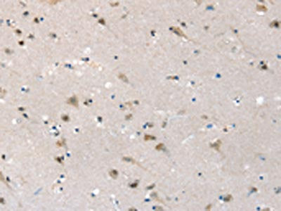 The image on the left is immunohistochemistry of paraffin-embedded Human brain tissue using CSB-PA211832(SLC6A7 Antibody) at dilution 1/30, on the right is treated with synthetic peptide. (Original magnification: ×200)