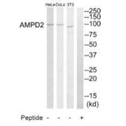 Western blot analysis of extracts from HeLa cells, NIH-3T3 cells and COLO205 cells, using AMPD2 antibody.