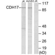 Western blot analysis of extracts from Jurkat cells and HUVEC cells, using CDH17 antibody.