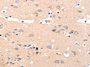 The image on the left is immunohistochemistry of paraffin-embedded Human brain tissue using CSB-PA212407(OLR1 Antibody) at dilution 1/12, on the right is treated with synthetic peptide. (Original magnification: ×200)