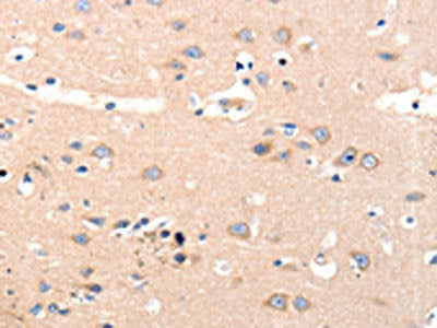 The image on the left is immunohistochemistry of paraffin-embedded Human brain tissue using CSB-PA212407(OLR1 Antibody) at dilution 1/12, on the right is treated with synthetic peptide. (Original magnification: ×200)