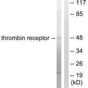 Western blot analysis of extracts from HeLa cells, treated with Nocodazole (1ug/ml, 18hours), using Thrombin Receptor antibody.