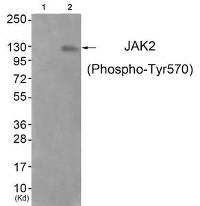 Western blot analysis of extracts from JK cells (Lane 2), using JAK2 (Phospho-Tyr570) Antibody. The lane on the left is treated with antigen-specific peptide.