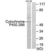 Western blot analysis of extracts from HT-29 cells, using Cytochrome P450 2B6 antibody.
