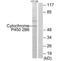 Western blot analysis of extracts from HT-29 cells, using Cytochrome P450 2B6 antibody.