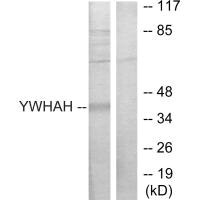 Western blot analysis of extracts from Jurkat cells, using 14-3-3 η antibody.