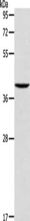Gel: 10%SDS-PAGE, Lysate: 40 ug, Lane: Raji cells, Primary antibody: CSB-PA213113(AGA Antibody) at dilution 1/125, Secondary antibody: Goat anti rabbit IgG at 1/8000 dilution, Exposure time: 30 seconds