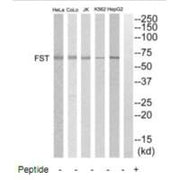 Western blot analysis of extracts from HepG2, K562, COLO205, Jurkat and HeLa cells, using FST antibody.