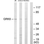 Western blot analysis of extracts from Jurkat cells, COLO205 cells and HUVEC cells, using GRK6 antibody.