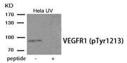 Western blot analysis of extracts from HeLa cells treated with UV using Phospho-VEGFR1 (Tyr1213) antibody.The lane on the right is treated with the antigen-specific peptide.