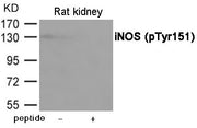 Western blot analysis of extracts from Rat kindey using iNOS (Phospho-Tyr151) Antibody.The lane on the right is treated with the antigen-specific peptide.