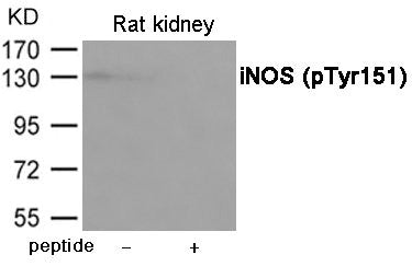 Western blot analysis of extracts from Rat kindey using iNOS (Phospho-Tyr151) Antibody.The lane on the right is treated with the antigen-specific peptide.