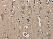 The image on the left is immunohistochemistry of paraffin-embedded Human brain tissue using CSB-PA213997(SERPINA1 Antibody) at dilution 1/50, on the right is treated with fusion protein. (Original magnification: ×200)