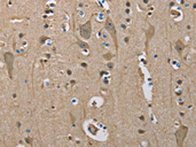 The image on the left is immunohistochemistry of paraffin-embedded Human brain tissue using CSB-PA213997(SERPINA1 Antibody) at dilution 1/50, on the right is treated with fusion protein. (Original magnification: ×200)