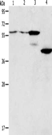 Gel: 10%SDS-PAGE, Lysate: 40 ug, Lane 1-4: A375 cells, A172 cells, mouse pancreas tissue, human liver cancer tissue, Primary antibody: CSB-PA214066(PGBD2 Antibody) at dilution 1/550, Secondary antibody: Goat anti rabbit IgG at 1/8000 dilution, Exp...