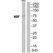 Western blot analysis of extracts from CoLo cells, using NSF antibody.