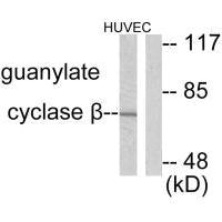 Western blot analysis of extracts from HuvEc cells, using Guanylate Cyclase β antibody.