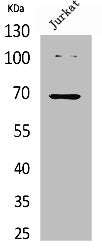 Western Blot analysis of Jurkat cells using Acetyl-Ku-70 (K542) Polyclonal Antibody.