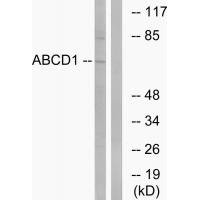 Western blot analysis of extracts from Jurkat cells, using ABCD1 antibody.