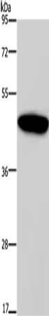 Gel: 10%SDS-PAGE, Lysate: 40 ug, Lane: Mouse pancreas tissue, Primary antibody: CSB-PA214765(GIPR Antibody) at dilution 1/200, Secondary antibody: Goat anti rabbit IgG at 1/8000 dilution, Exposure time: 10 seconds