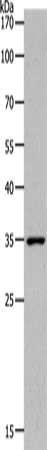 Gel: 10%SDS-PAGE, Lysate: 40 ug, Lane: Human fetal kidney tissue, Primary antibody: CSB-PA214837(MC2R Antibody) at dilution 1/1400, Secondary antibody: Goat anti rabbit IgG at 1/8000 dilution, Exposure time: 2 minutes