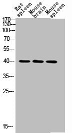 Western blot analysis of RAT-SPLEEN MOUSE-BRAIN MOUSE-SPLEEN lysis using CD72 antibody. Antibody was diluted at 1:2000. Secondary antibody was diluted at 1:20000