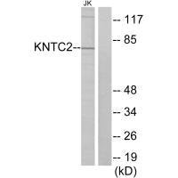 Western blot analysis of extracts from Jurkat cells, using KNTC2 antibody.