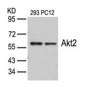 Western blot analysis of extracts from 293 and PC12 cells using Akt2(Ab-474) Antibody.
