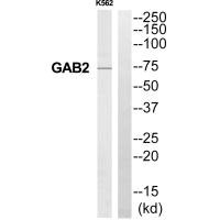 Western blot analysis of extracts from K562 cells, using GAB2 antibody.