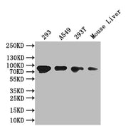 Western Blot Positive WB detected in: 293 whole cell lysate, A549 whole cell lysate, 293T whole cell lysate, Mouse Liver tissue lysate All lanes: PROX1 antibody at 1:1000 Secondary Goat polyclonal to rabbit IgG at 1/50000 dilution Predicted band s...