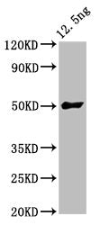 Western Blot Positive WB detected in Recombinant protein All lanes: FTL3 antibody at 5.7µg/ml Secondary Goat polyclonal to rabbit IgG at 1/50000 dilution Predicted band size: 50 kDa Observed band size: 50 kDa