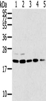 Gel: 12%SDS-PAGE, Lysate: 40 ug, Lane 1-5: 293T cells, 231 cells, PC3 cells, A549 cells, K562 cells, Primary antibody: CSB-PA215944(TPD52L1 Antibody) at dilution 1/300, Secondary antibody: Goat anti rabbit IgG at 1/8000 dilution, Exposure time: 10...