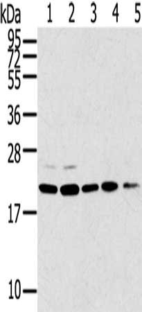 Gel: 12%SDS-PAGE, Lysate: 40 ug, Lane 1-5: 293T cells, 231 cells, PC3 cells, A549 cells, K562 cells, Primary antibody: CSB-PA215944(TPD52L1 Antibody) at dilution 1/300, Secondary antibody: Goat anti rabbit IgG at 1/8000 dilution, Exposure time: 10...