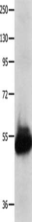 Gel: 8%SDS-PAGE, Lysate: 40 ug, Lane: Human kidney cancer tissue, Primary antibody: CSB-PA216217(KCNA1 Antibody) at dilution 1/600, Secondary antibody: Goat anti rabbit IgG at 1/8000 dilution, Exposure time: 20 seconds