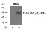 Western blot analysis of extracts from HT29 cells, untreated or treated with UV using Ephrin-B2(Phospho-Tyr330) Antibody.
