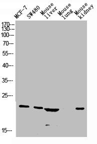 Western blot analysis of Jurkat U937 Raji mouse-eye lysate, antibody was diluted at 1000. Secondary antibody was diluted at 1:20000