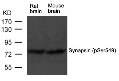 Western blot analysis of extract from rat brain and mouse brain tissue using Synapsin(phospho-Ser549) Antibody using
