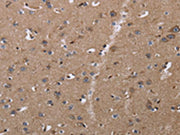 The image on the left is immunohistochemistry of paraffin-embedded Human brain tissue using CSB-PA216811(CLDN23 Antibody) at dilution 1/30, on the right is treated with fusion protein. (Original magnification: ×200)
