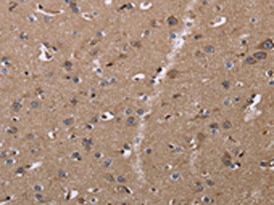 The image on the left is immunohistochemistry of paraffin-embedded Human brain tissue using CSB-PA216811(CLDN23 Antibody) at dilution 1/30, on the right is treated with fusion protein. (Original magnification: ×200)