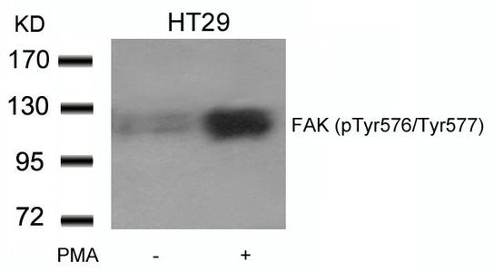 Western blot analysis of extracts from HT29 cells untreated or treated with PMA using FAK(phospho-Tyr576/Tyr577) Antibody.
