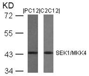Western blot analysis of extracts from PC12 and C2C12 cells using SEK1/MKK4(Ab-80) Antibody.